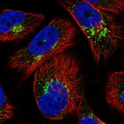 WDTC1 Antibody, Novus Biologicals 0.1mL; Unlabeled:Antibodies, Polyclonal